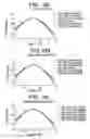 Fig. 24 - Presbyopia lens with pupil size correction based on level of refractive error