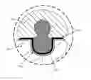 Fig. 01 - Electrically conductive lens connection and methods of making the same