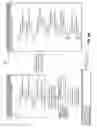 Fig. 07 - Table boundary detection in data blocks for compression