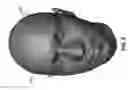 Fig. 06 - Head modeling for a therapeutic or diagnostic procedure