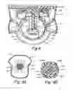 Fig. 06 - SYSTEM FOR SECURING A CHAIN OF CUSTODY OF A SPECIMEN OF A DONOR