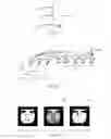 Fig. 09 - Image processing using cellular simultaneous recurrent network