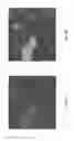 Fig. 06 - Anomaly detection in medical imagery