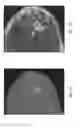 Fig. 08 - Anomaly detection in medical imagery