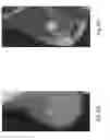 Fig. 09 - Anomaly detection in medical imagery