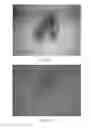 Fig. 06 - Method, system, and light source for penetrating radiation imaging