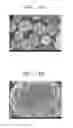 Fig. 05 - Positive active material, positive electrode, lithium battery including the same, and method of manufacturing thereof