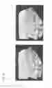 Fig. 13 - Image processing device for compositing panoramic images, image processing program and recording medium