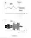 Fig. 10 - Photographing method of an electronic device and the electronic device thereof