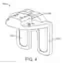 Fig. 05 - Force sensing distal femoral alignment system and method of use