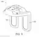 Fig. 06 - Force sensing distal femoral alignment system and method of use