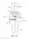 Fig. 19 - Force sensing distal femoral alignment system and method of use
