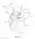 Fig. 22 - Force sensing distal femoral alignment system and method of use