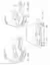 Fig. 28 - Force sensing distal femoral alignment system and method of use