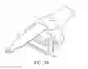 Fig. 37 - Force sensing distal femoral alignment system and method of use