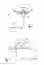 Fig. 02 - Method of Destroying Tissue Cells by Electroporation