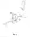 Fig. 07 - Wheelchair including a collapsible and/or angle adjustable backrest frame