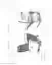 Fig. 09 - Communication methods for patient handling devices