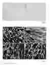 Fig. 02 - Application of stem cells in the orthodontic maxillary expansion