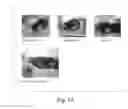 Fig. 02 - METHODS AND PRODUCTS FOR TREATING PROLIFERATIVE DISEASES