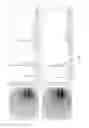 Fig. 02 - Methods and compositions for detecting drusen and predicting age-related macular degeneration