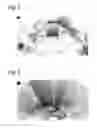 Fig. 02 - Composition and method for medical imaging of body cavities