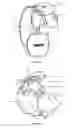 Fig. 08 - Dry powder inhaler