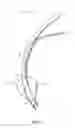 Fig. 02 - Endotracheal cuff and technique for using the same