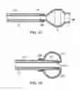 Fig. 03 - Methods and devices for passive residual lung volume reduction and functional lung volume expansion