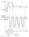 Fig. 07 - Methods and devices for passive residual lung volume reduction and functional lung volume expansion