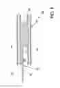 Fig. 07 - Endovascular devices and methods for exploiting intramural space
