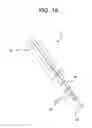Fig. 02 - Intravascular catheters, systems, and methods