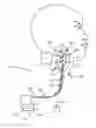 Fig. 01 - Apparatus for baroreceptor stimulation therapy