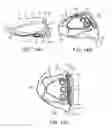 Fig. 11 - Golf club