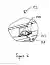 Fig. 03 - APPARATUS FOR DIRECTLY APPLYING LIQUID TO A SUBSTRATE