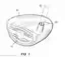 Fig. 02 - Method of forming golf club head assembly
