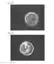 Fig. 25 - Method of using device of processing tempered glass