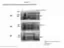 Fig. 02 - Production and delivery of a stable collagen