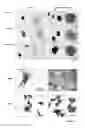 Fig. 06 - Method for isolation and purification of epithelial stem cells from skin