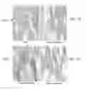 Fig. 02 - Methods and compositions for treating neurological disease