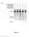 Fig. 06 - DELIVERY, USE AND THERAPEUTIC APPLICATIONS OF THE CRISPR-CAS SYSTEMS AND COMPOSITIONS FOR TARGETING DISORDERS AND DISEASES USING PARTICLE DELIVERY COMPONENTS