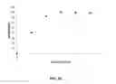 Fig. 19 - BIOSENSING SYSTEMS AND METHODS FOR ASSESSING ANALYTE CONCENTRATIONS