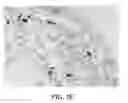 Fig. 06 - METHODS FOR DIAGNOSING IGG4-RELATED DISEASE