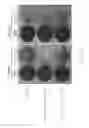 Fig. 09 - Method for treating liver cancer