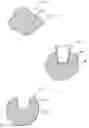 Fig. 01 - CONFORMABLE SHAPE MEMORY ARTICLE