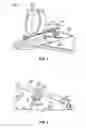 Fig. 02 - Leg retaining clip