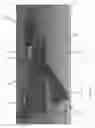 Fig. 08 - Retractable handle arrangement