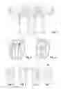 Fig. 02 - Variable lift valve train of an internal combustion engine
