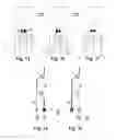 Fig. 04 - Variable lift valve train of an internal combustion engine