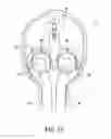 Fig. 09 - Valve positioning structure